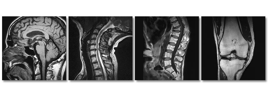 Siemens high-field MRI